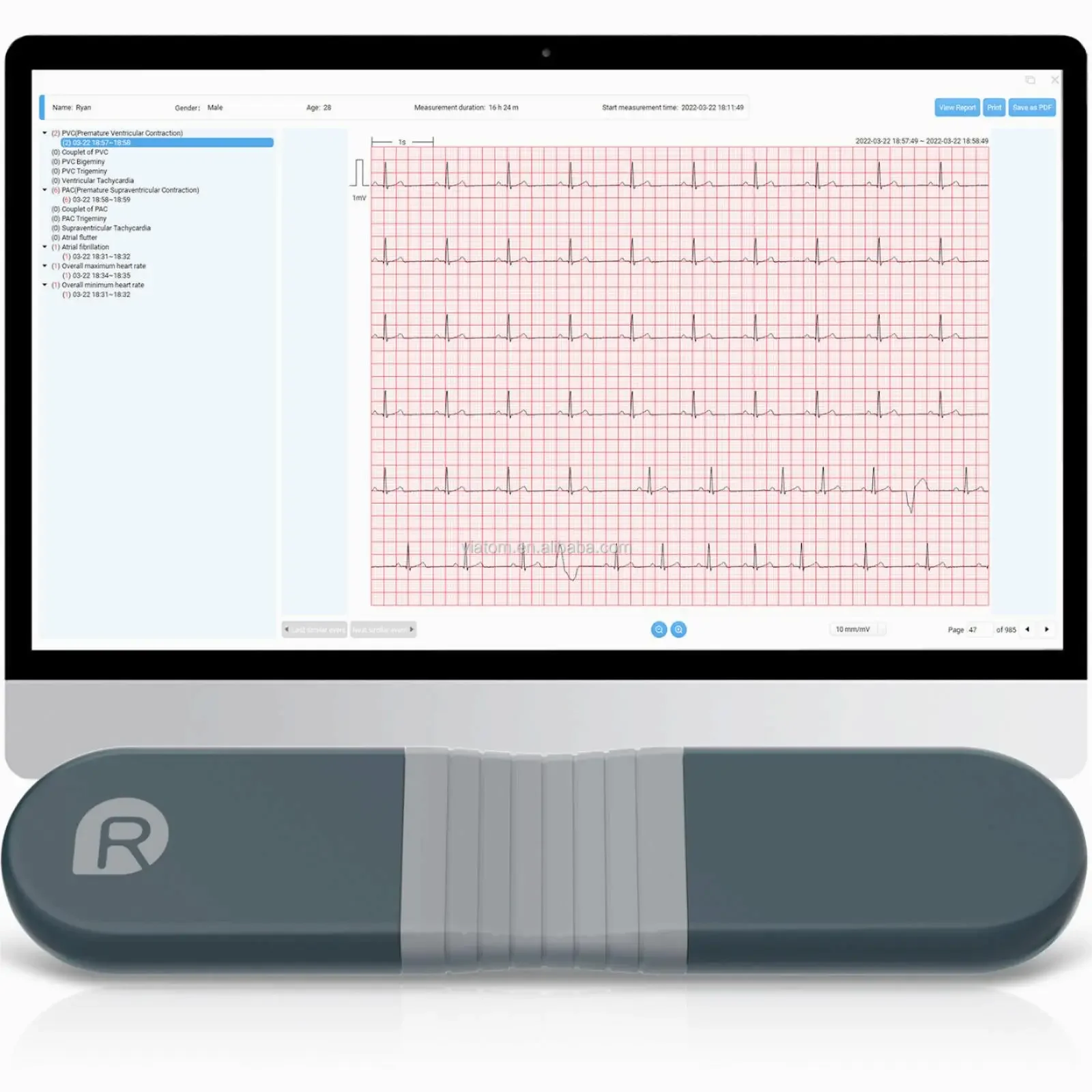 Wireless Bluetooth Dynamic Rec – Ecg Patch Monitor Bewertung und Preis